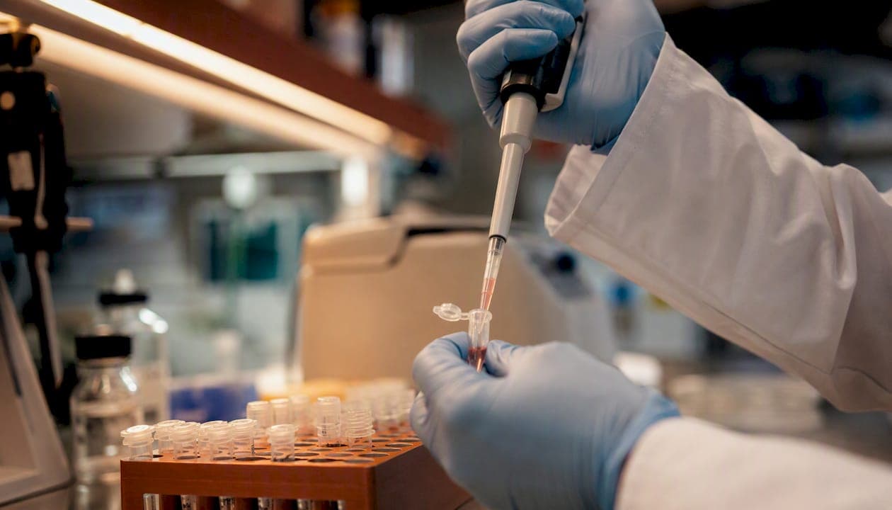Interesting Facts About Duchenne Muscular Dystrophy