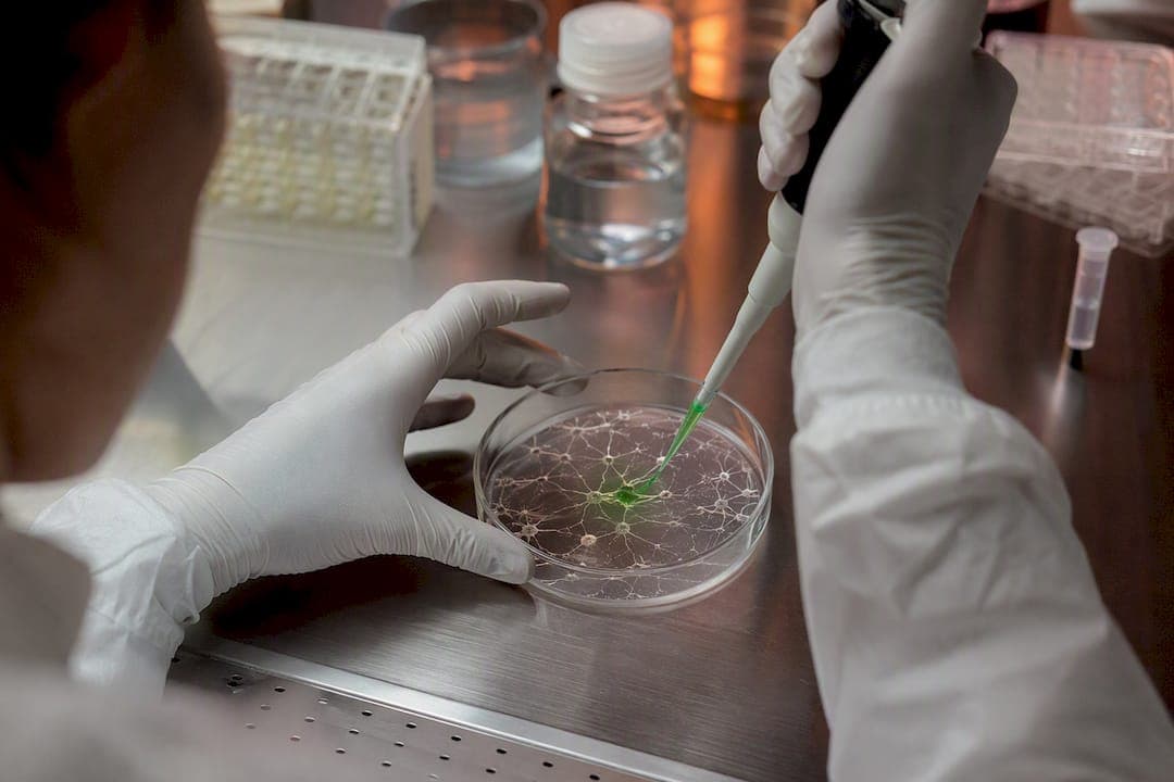 Autophagy Assays for iPSC Models: A Researcher's Protocol Guide
