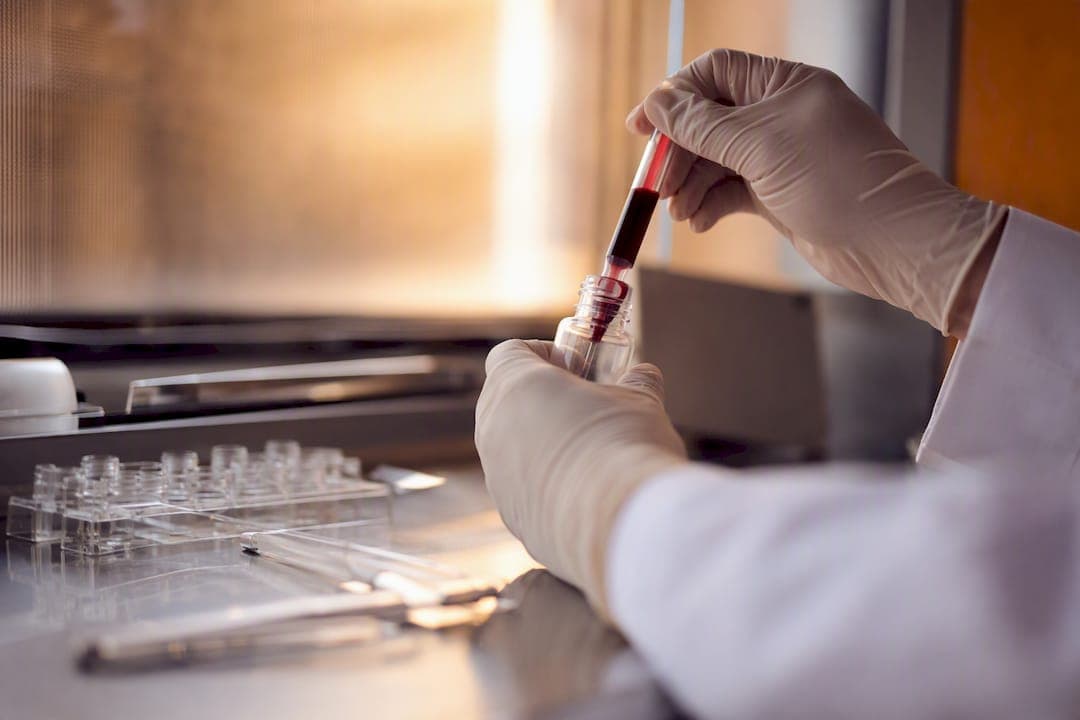 Recopilar datos clínicos ya: la urgencia detrás del modelado iPSC