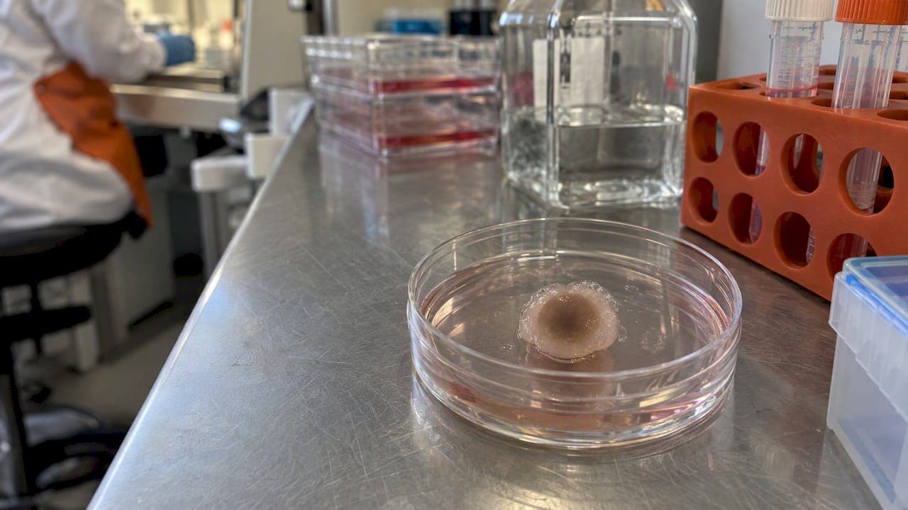 Modélisation des maladies rétiniennes avec les organoïdes dérivés d'iPSC