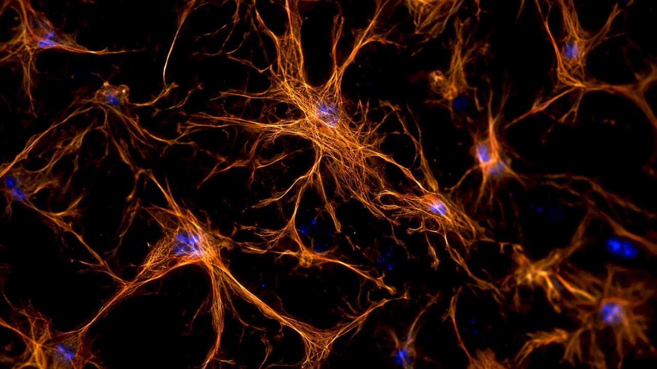 Modelos de astrócitos derivados de iPSC: guia para doenças raras